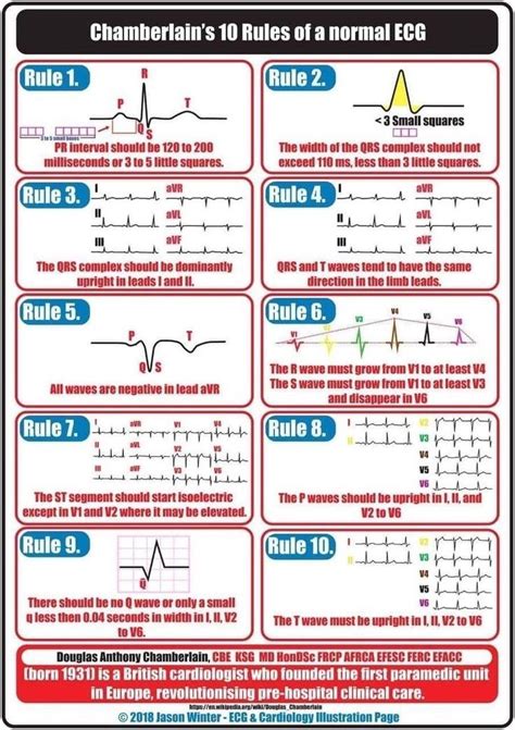 stripcheat|Printable Ekg Cheat Sheet